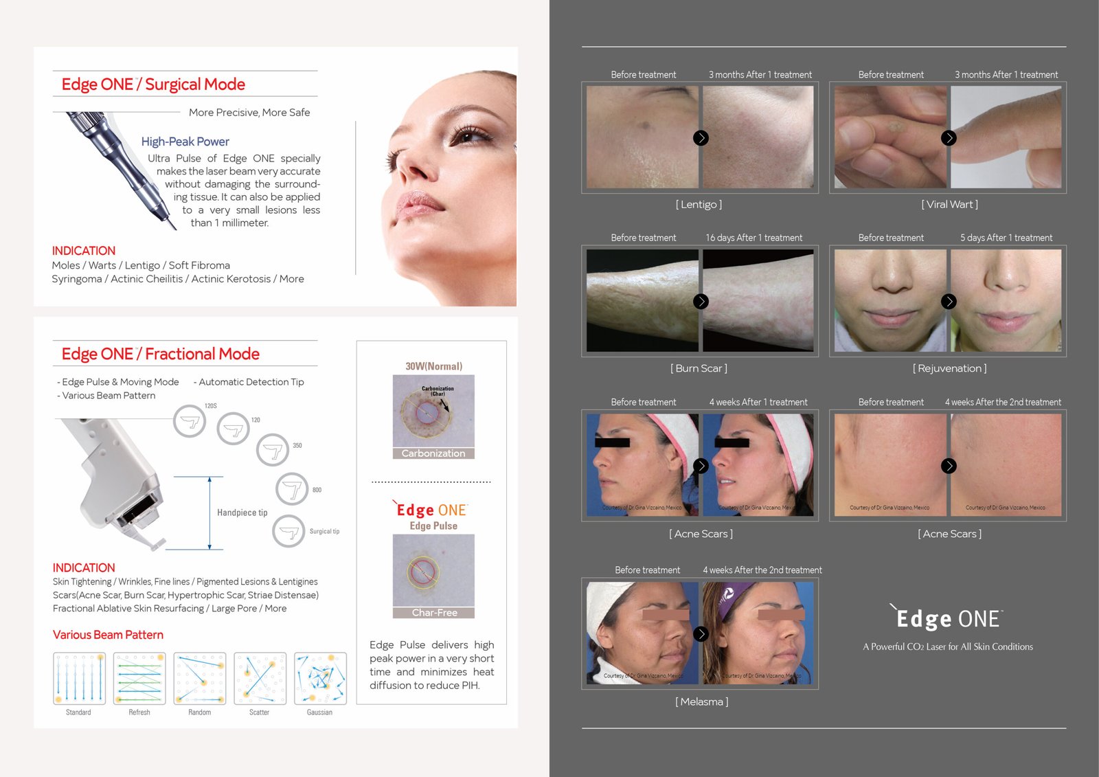 Edge ONE™ CO_2$ - Image 3