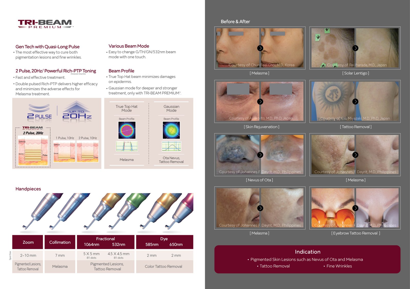 TRI-BEAM PREMIUM™ - Image 3