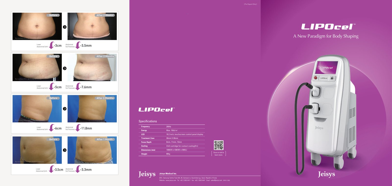 LIPOCEL (HIFU) - Image 2